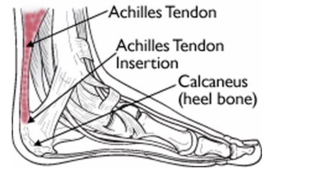 Ахиллово сухожилие крепится. Ахиллово сухожилие анатомия. Тендинит ахиллового сухожилия. Тендиноз сухожилия пяточной кости. Тендинит сухожилия большеберцовой мышцы.